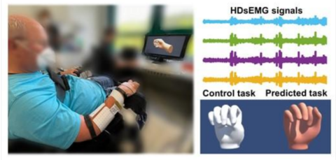 Towards entry "On intent detection for complete SCI patients"